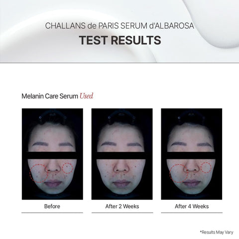 AMPOULE d'ALBAROSA EXCELLENCE